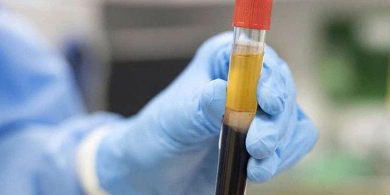 Effectiveness of convalescent plasma therapy in severe COVID-19 patients