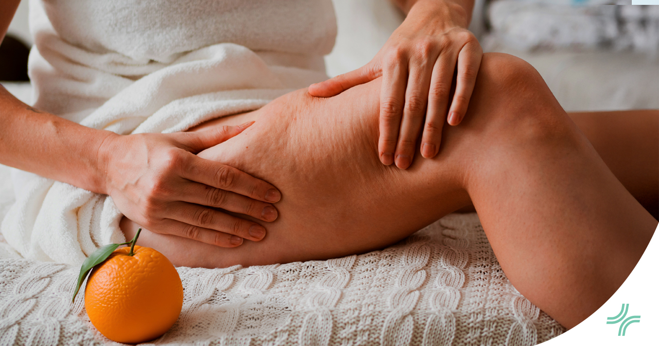 Cellulite et peau d’orange : un regard nouveau sur notre corps